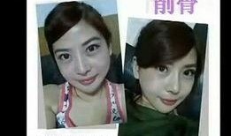 台湾爆料谁整容了啊视频,明星整容真相大曝光！